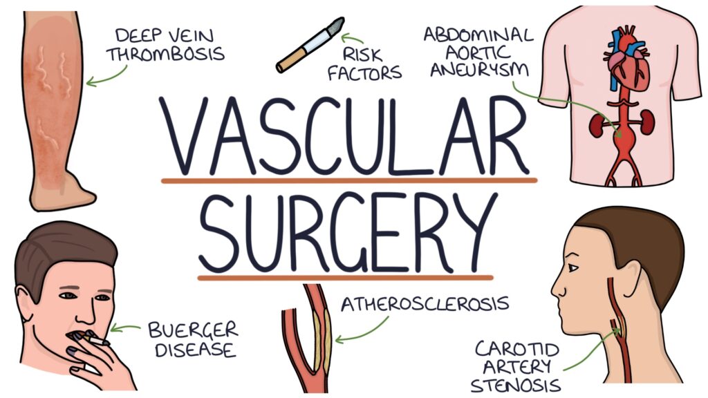 Vascular Surgeon